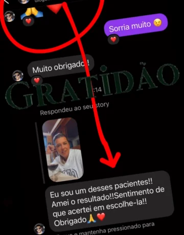 Carvalho depoimentos (5)