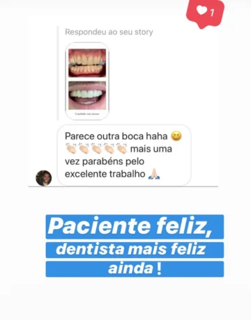 Carvalho depoimentos