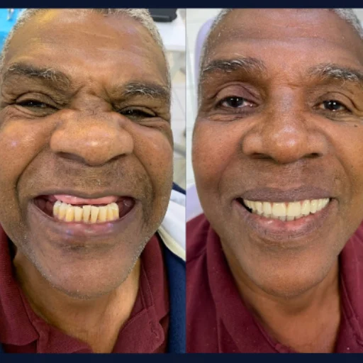 Carvalho e Marino antes e depois