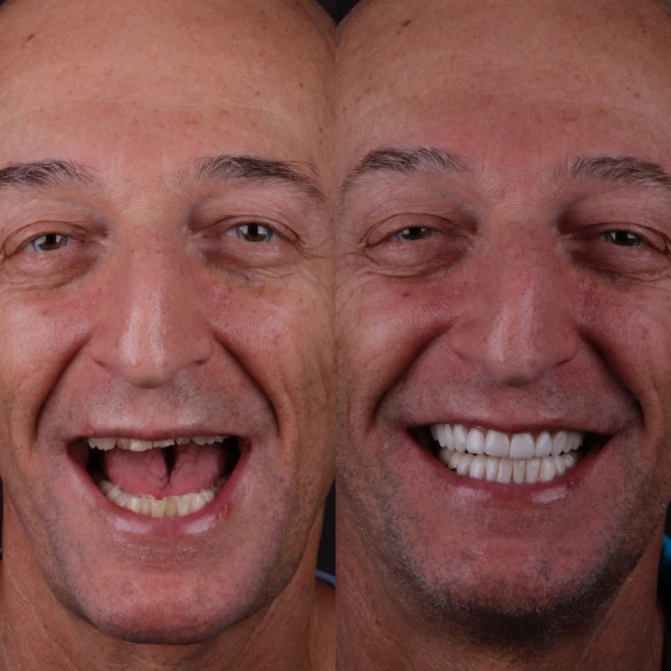 Carvalho&marino Odontologia antes e depois (1)