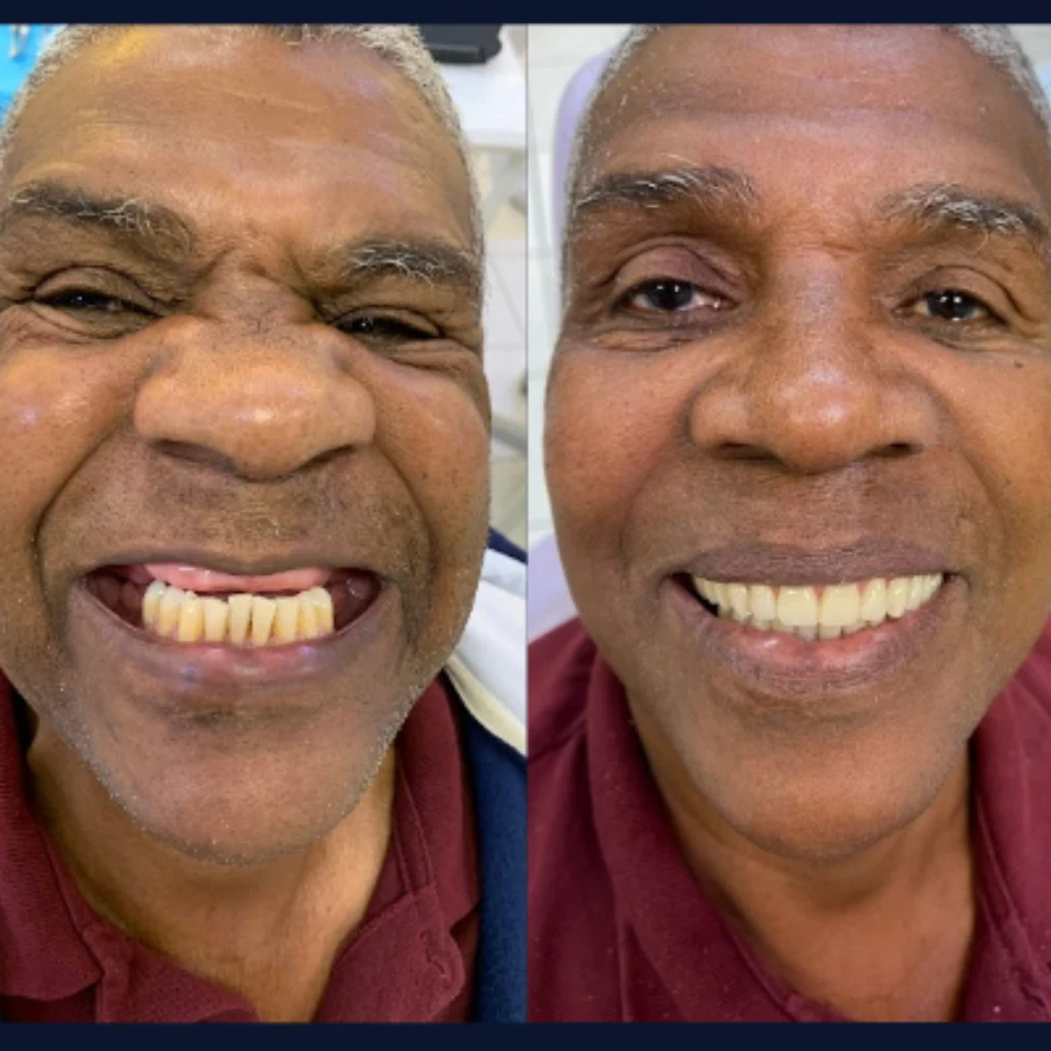 Carvalho&marino Odontologia antes e depois (4)