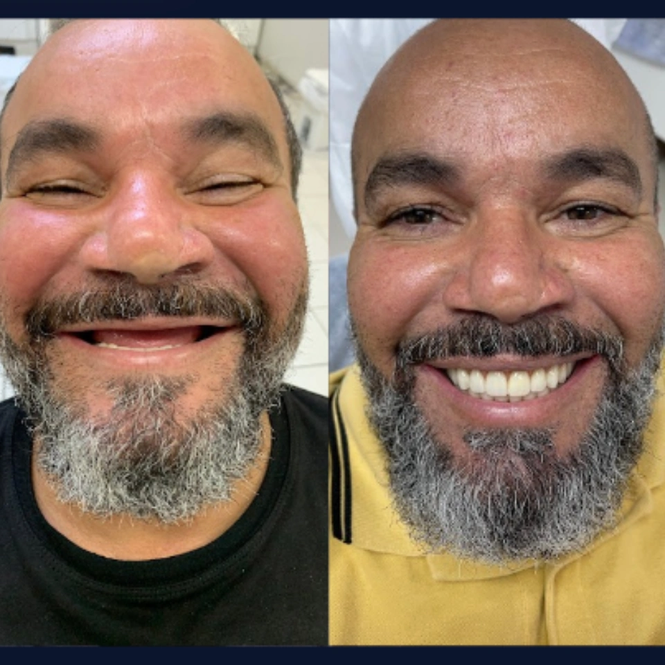 Carvalho&marino Odontologia antes e depois (5)
